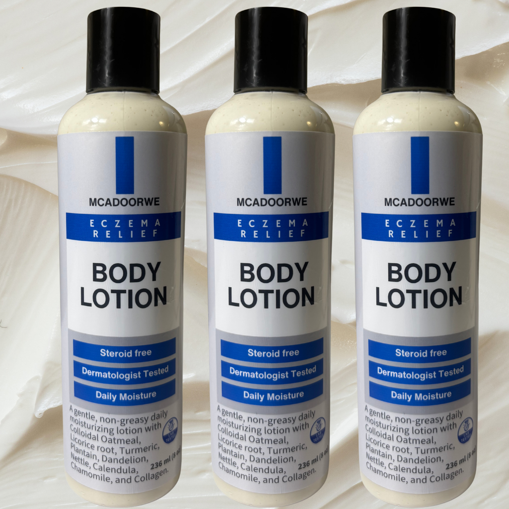Herbal Eczema Body Lotion|8 oz| Moisturizing| Colloidal Oatmeal |Calendula| Licorice Root| Plantain Leaf| Dandelion